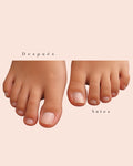 Limpieza de uñas de pies