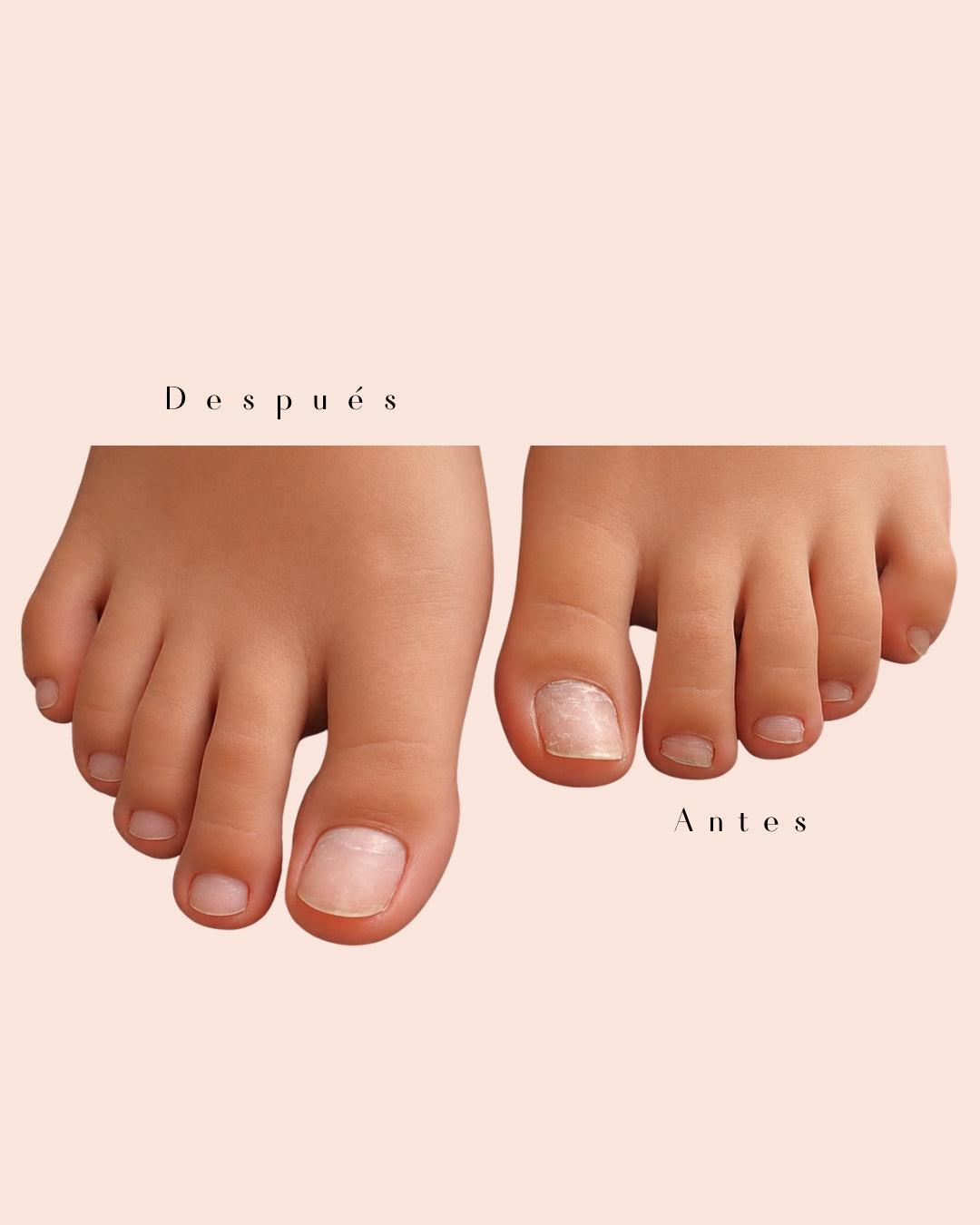 Limpieza de uñas de pies